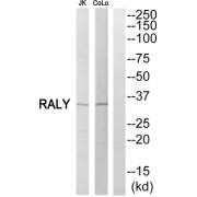 Western blot analysis of extracts from Jurkat cells and COLO205 cells, using RALY antibody.