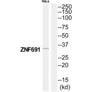 Zinc Finger Protein 691 (ZNF691) Antibody