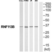 Western blot analysis of various cell lines, using RNF113B antibody. The lane on the right is blocked with the synthesized peptide.