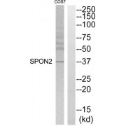 Western blot analysis of extracts from COS7 cells, using SPON2 antibody.