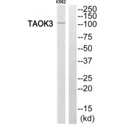 Western blot analysis of extracts from K562 cells, using TAOK3 antibody.