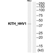 WB analysis of HeLa cell lysate, using Thymidine Kinase (TK) Antibody. The right lane was treated with the corresponding peptide.