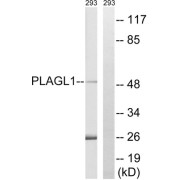 Western blot analysis of extracts from 293 cells, using PLAGL1 antibody.