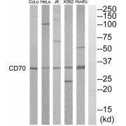 Western blot analysis of extracts from HuvEC, K562, HepG2, Jurkat, HeLa and COLO205 cells, using CD70 antibody.