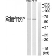 Western blot analysis of extracts from HeLa cells and A549 cells, using Cytochrome P450 11A1 antibody.