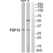 Western blot analysis of extracts from Jurkat cells and HepG2 cells, using FGF13 antibody.