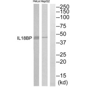Western blot analysis of extracts from HepG2 and HeLa cells, using IL18BP antibody.