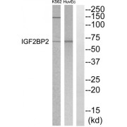 Western blot analysis of extracts from HuvEC and K562 cells, using IGF2BP2 antibody.