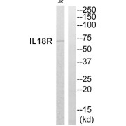 Western blot analysis of extracts from Jurkat cells, using IL18R antibody.