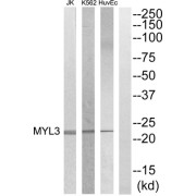 Western blot analysis of extracts from HuvEC, K562 and Jurkat cells, using MYL3 antibody.