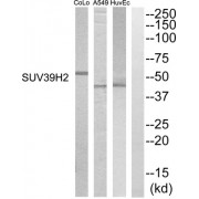 Western blot analysis of extracts from HuvEC, A549 and COLO205 cells, using SUV39H2 antibody.