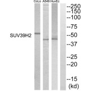 Western blot analysis of extracts from HuvEC, A549 and COLO205 cells, using SUV39H2 antibody.