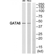 Western blot analysis of extracts from 293 cells and HeLa cells, using GATA6 antibody.