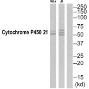 Cytochrome P450 21 Antibody