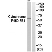 Western blot analysis of extracts from 293 cells, using CYP8B1 antibody.