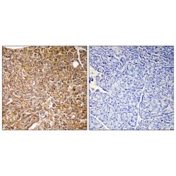 Phosphatidylinositol 4,5-Bisphosphate 3-Kinase Catalytic Subunit Gamma Isoform (PIK3CG) Antibody