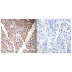 BAG Family Molecular Chaperone Regulator 3 (BAG3) Antibody