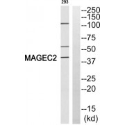 Western blot analysis of extracts from 293 cells, using MAGEC2 antibody.