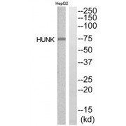 Western blot analysis of extracts from HepG2 and HuvEc cells, using HUNK antibody.