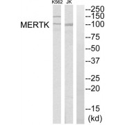 Western blot analysis of extracts from K562 cells and Jurkat cells, using MERTK antibody.