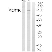 Western blot analysis of extracts from K562 cells and Jurkat cells, using MERTK antibody.