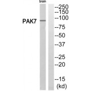 Western blot analysis of extracts from rat brain cells, using PAK7 antibody.