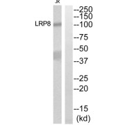 Western blot analysis of extracts from Jurkat cells, using LRP8 antibody.