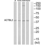 Western blot analysis of extracts from HepG2, HuvEc, Jurkat and A549 cells, using ACTBL2 antibody.