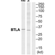 abx015190