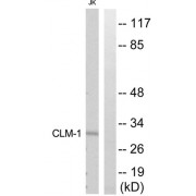 Western blot analysis of extracts from Jurkat cells, using CLM-1 antibody.