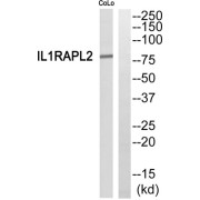 Western blot analysis of extracts from COLO205 cells, using IL1RAPL2 antibody.