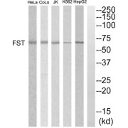 Western blot analysis of extracts from HepG2, K562, COLO205, Jurkat and HeLa cells, using FST antibody.