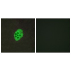 5-Hydroxytryptamine Receptor 4 (HTR4) Antibody