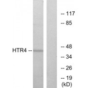 Western blot analysis of extracts from NIH-3T3 cells, using HTR4 antibody.