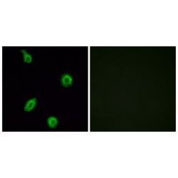 HTR5B Antibody