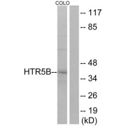 abx015214