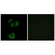 abx015220