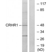 Western blot analysis of extracts from HT-29 cells, using CRHR1 antibody.