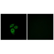 Immunofluorescence analysis of A549 cells, using CD234 antibody.