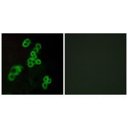 Lysophosphatidic Acid Receptor Edg-2 (EDG2) Antibody