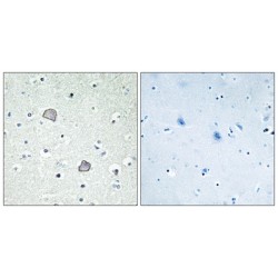 Lysophosphatidic Acid Receptor Edg-2 (EDG2) Antibody