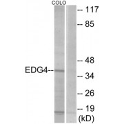 Western blot analysis of extracts from COLO205 cells, using EDG4 antibody.