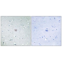Prostaglandin E2 Receptor EP3 Subtype (PE2R3) Antibody