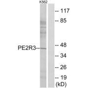 Western blot analysis of extracts from K562 cells, using PE2R3 antibody.