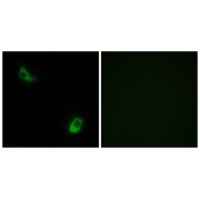 Immunofluorescence analysis of LOVO cells, using FPRL2 antibody.