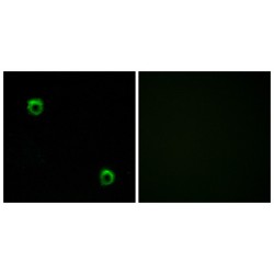 Frizzled Homolog 2 (FZD2) Antibody