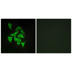 G-Protein Coupled Receptor 100 (GPR100) Antibody