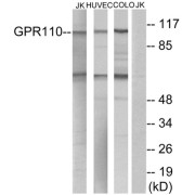 Western blot analysis of extracts from Jurkat cells, HUVEC cells and COLO cells, using GPR110 antibody.