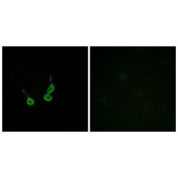 Probable G-Protein Coupled Receptor 150 (GPR150) Antibody