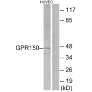 Western blot analysis of extracts from HUVEC cells, using GPR150 antibody.